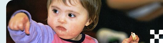 photo of a girl with downs syndrome